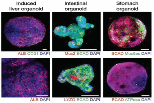 Establishment of a multiorgan model by integrating 3D induced liver tissue with intestinal and stomach organoids in a high-throughput microfluidic device.