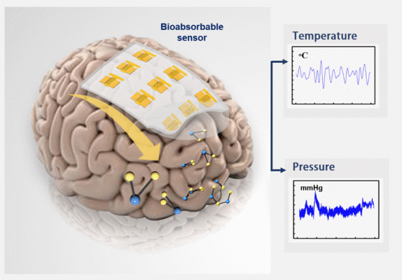 Transient circuits are designed to perform their function over a predetermined time period and then naturally dissolve; they can be embedded into the human body as sensors for clinical applications without causing any harm nor leaving any residue.
